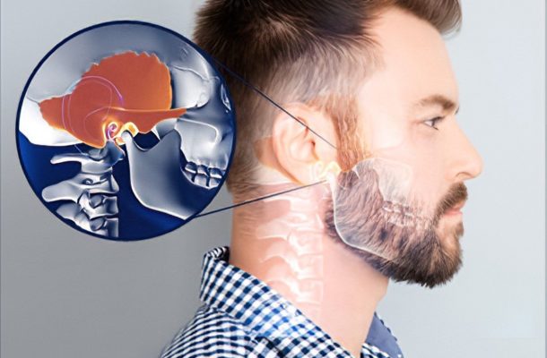 تشخیص و درمان اختلال Tmj-Mpd (اختلال در عملکرد مفصل گیجگاهی)