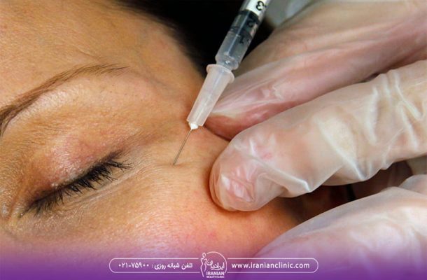 بهترین سن بوتاکس چه سنی است؟